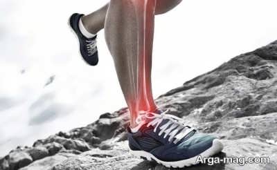 درمان درد ساق پاها