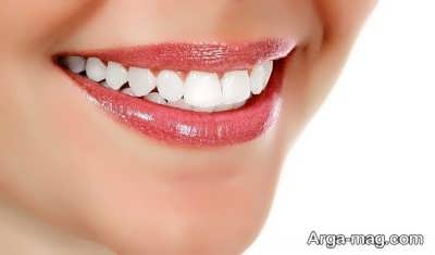 سفید شدن دندان
