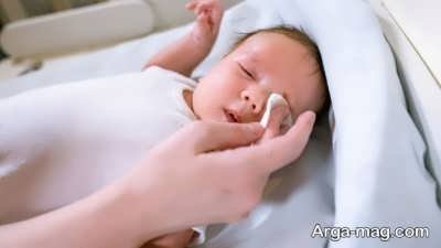عفونت چشمهای نوزاد