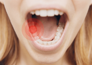 درمان طبیعی دندان درد در خانه