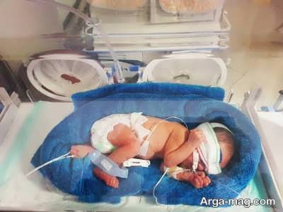 هیپوترمی در نوزاد نارس و بیمار