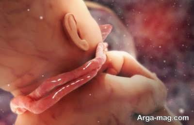 زیاد شدن مایع دور جنین 
