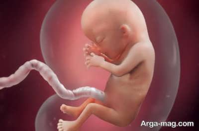 روش های درمان افزایش مایع دور جنین