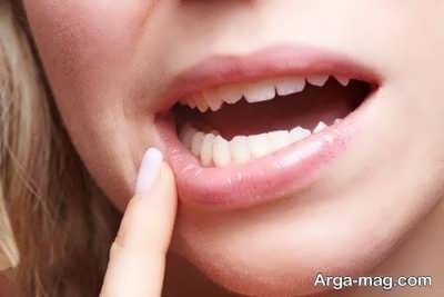 درمان خانگی عفونت دندان