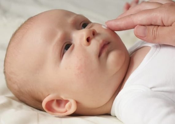 بررسی خشکی پوست نوزاد