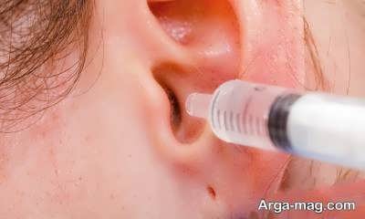 درمان گرفتگی گوش به روش ساده
