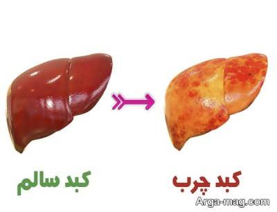 روش های گیاهی و خانگی جهت رفع چربی اضافی کبد