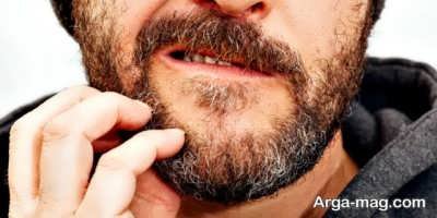درمان سفیدی ریش