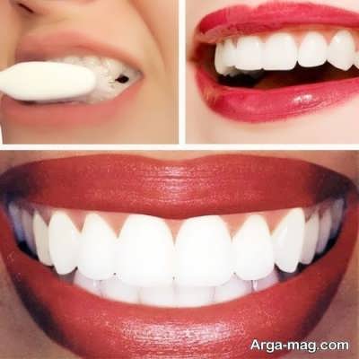 انواع بروساژ دندان در خانه