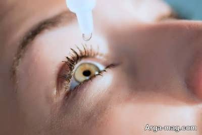  درمان خانگی برای عفونت چشم