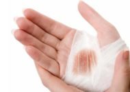 درمان خانگی عفونت زخم ها با روش های موثر