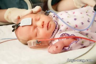 کم شنوایی نوزادان 