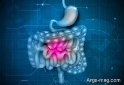 آشنایی با علائم کولیت روده