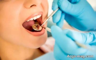 زمان مراجعه به پزشک برای درمان دندان پوسیده