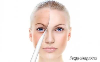 تاثیر اتوی صورت چگونه است؟