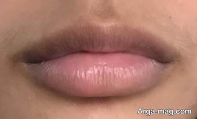 رفع تیرگی لب