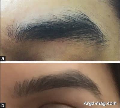 تفاوت بین ابروی خانم ها و آقایان 