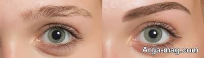 کاشت ابرو به روش طبیعی 
