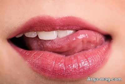 راهکارهای طبیعی برای درمان تلخی دهان
