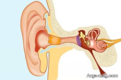 روش های رفع جرم گوش 