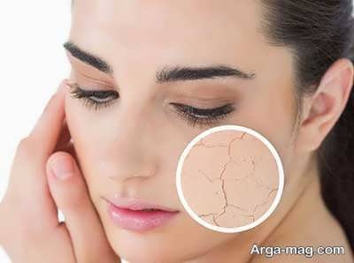 خاصیت نارگیل خشک بر سلامت پوست