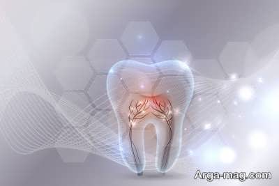 میناکاری دندان به چه معناست