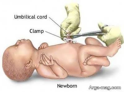 مراقبت از نوزاد تازه متولد شده چگونه است؟