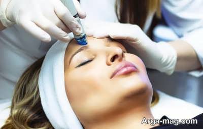 دستورالعمل اجرای هایفوتراپی روی پوست