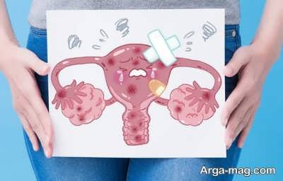 Cleansing the uterus 3 - پاکسازی رحم از عفونت و تقویت رحم با درمان های خانگی موثر