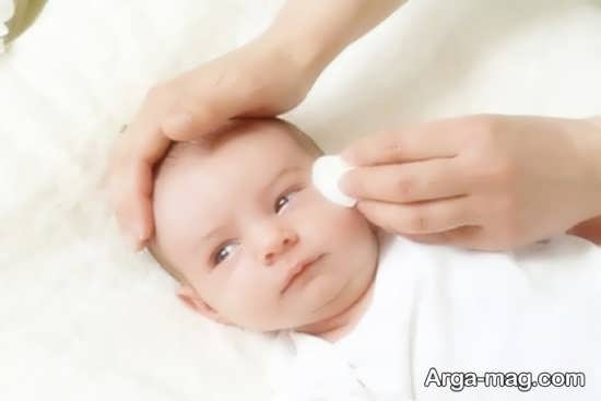 طریقه از بین بردن قی چشم کودک