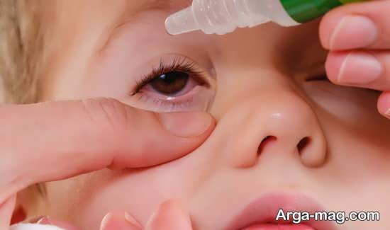 طریقه بهبودی قی چشم کودک