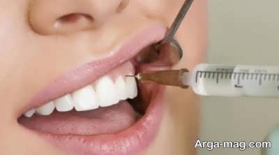 درمان عفونت بعد از کشیدن دندان