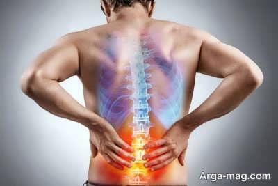 انجام آندوسکوپی دیسک کمر
