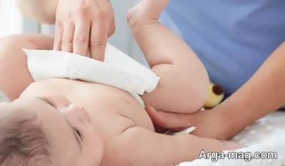 علت کاهش حجم ادرار نوزاد چیست