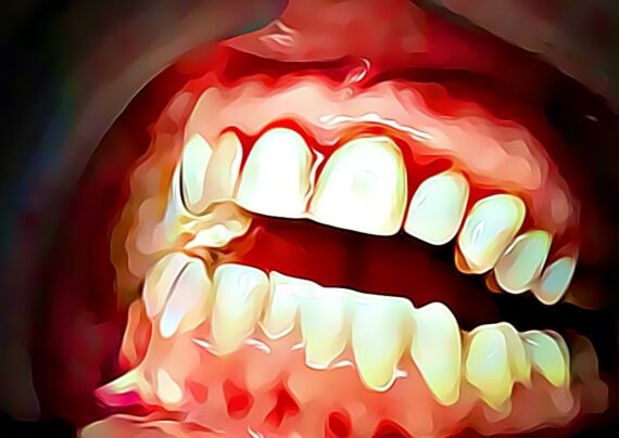 روش های جلوگیری از خونریزی دندان ها