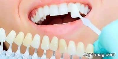 راه کار هایی برای درمان بی دندانی