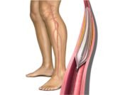 آشنایی با آناتومی ساق پا