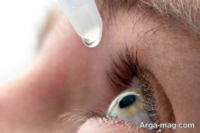 التهاب قرنیه و خشکی چشم ها 