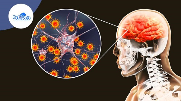 تبخال مغزی چیست؟ علائم و راه‌کارهای درمان آن