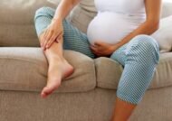 تورم مچ پا در بارداری و راه های درمانی