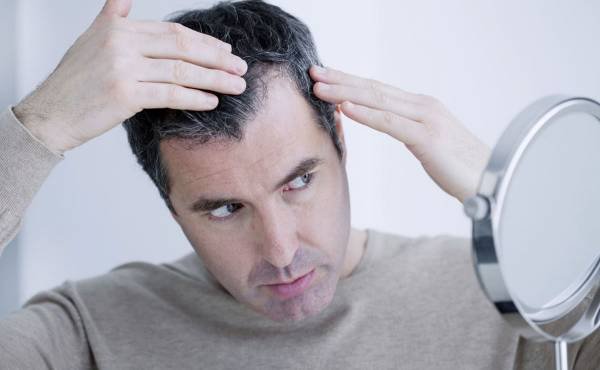 مهم ترین عوامل و دلایل ریزش مو چیست؟