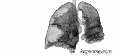 Lung emphysema disease 10