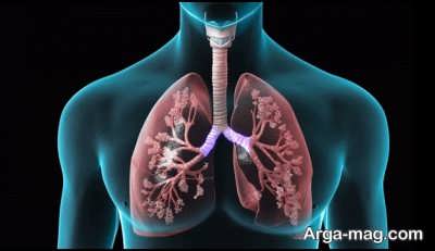 Lung emphysema disease 60