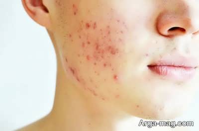 موارد استفاده از نورم اسکین