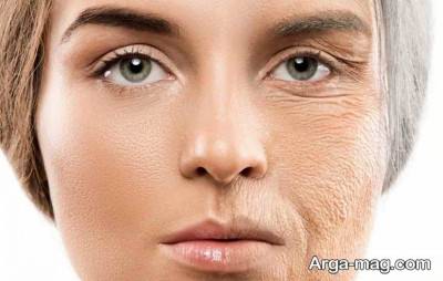 تاثیر سیگار بر چهره