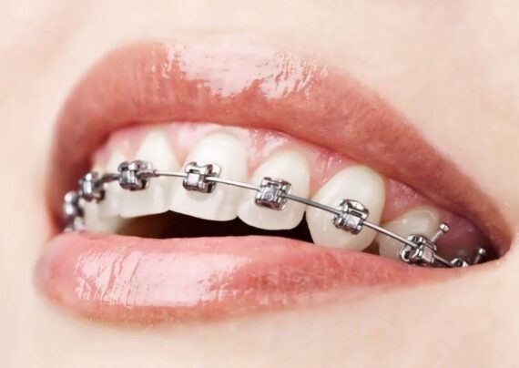 کاربرد میدلاین دندان چیست؟