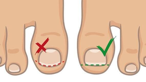 با کلینیک ارتوپدی دکتر مجید از عفونت ناخن پا و فرورفتگی آن جلوگیری کنید