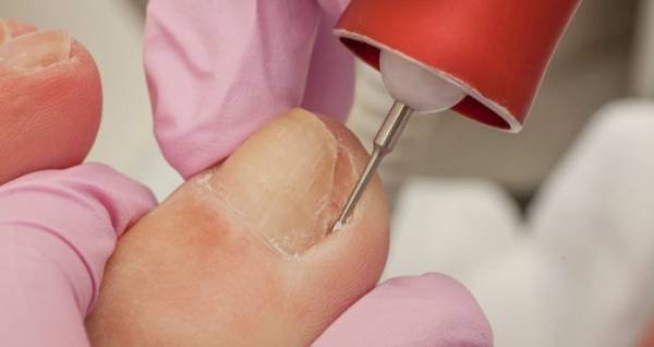 با کلینیک ارتوپدی دکتر مجید از عفونت ناخن پا و فرورفتگی آن جلوگیری کنید