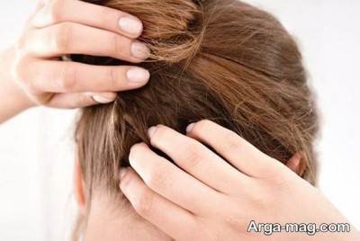 معرفی راه های درمان درد ریشه مو