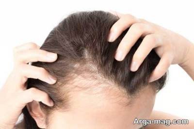 Hair root pain treatment (3) آرگا